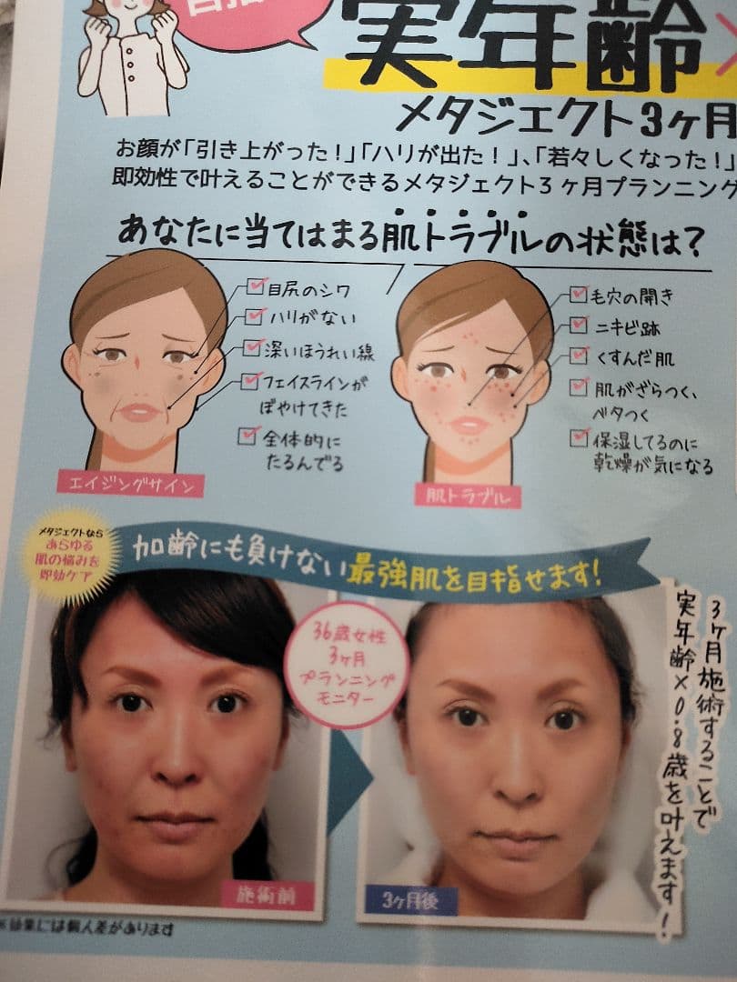 メタジェクト　美顔器のみ