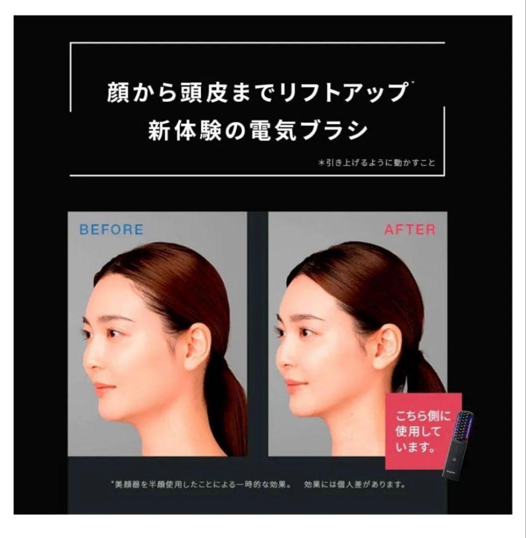 ELEKI BRUSH スカルプ美容器