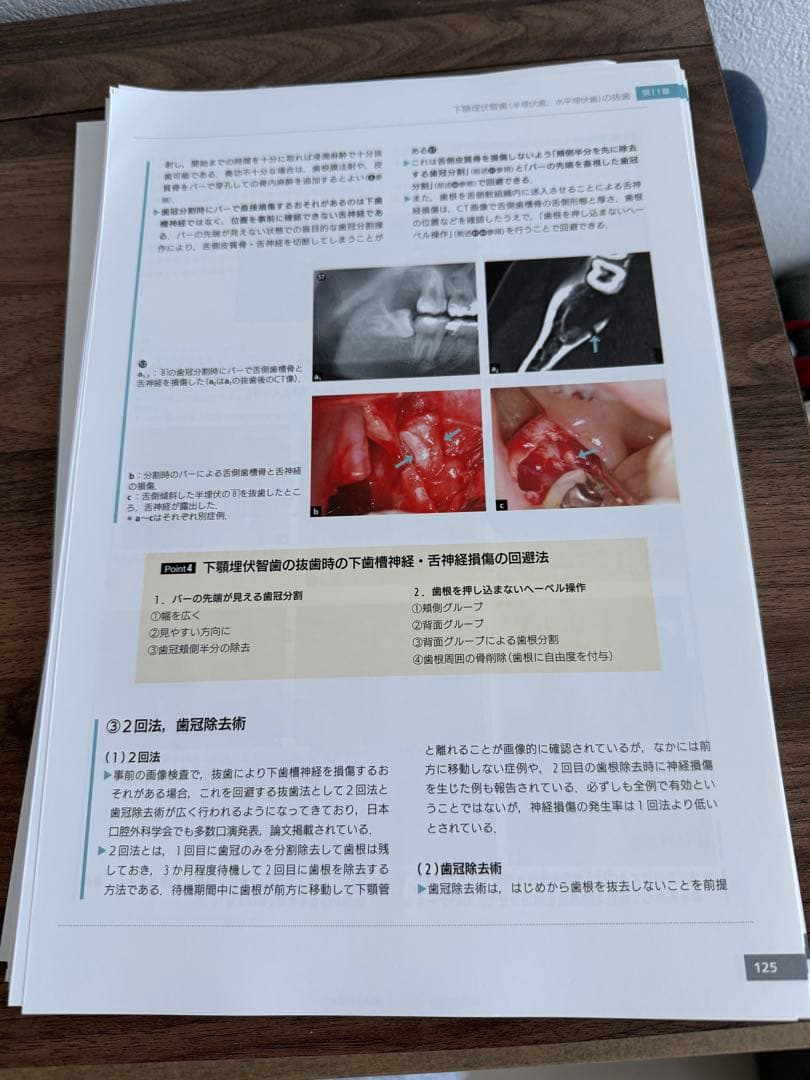 必ず上達 抜歯手技 増補新版　裁断済み