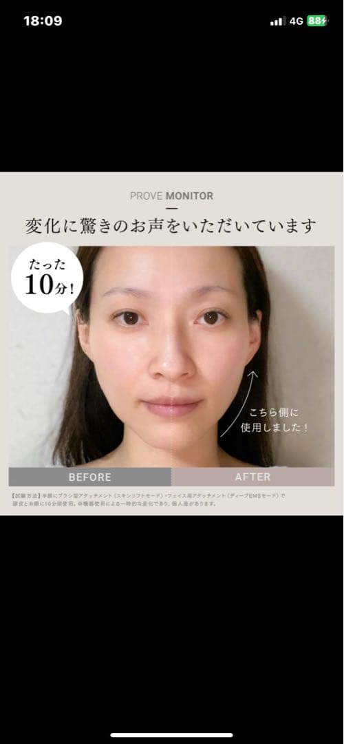 ボディ・フェイスケア EMS MYTREX PROVE