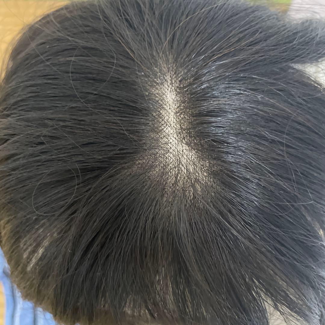 はな　マリブウィッグ　部分ウィッグ