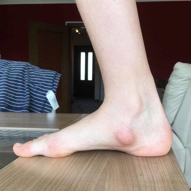 SK8INSOLL® DOUBLE AXEL カスタマイズインソール サイズL