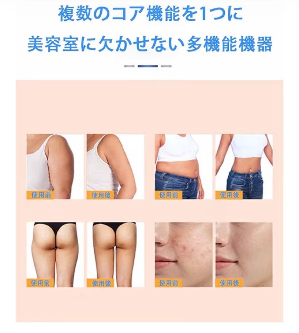 40KHZ キャビテーション+光ラジオ波