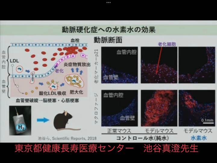 メルカリキャンペーンで値下げ敢行　水素ガス吸入器ラブリエエランの新品未開封品です