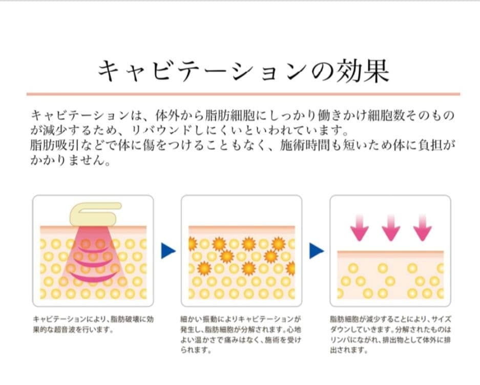 LIPO CUTTER キャビテーション&美顔器