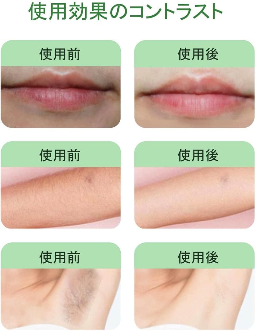 脱毛器 九段階調節 IPL光 VIO対応 光エステ フラッシュ式 50万回照射