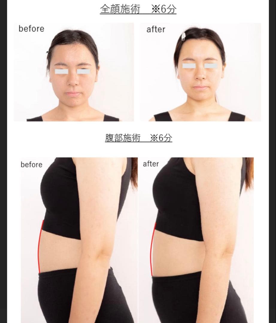 早い者勝ち！！パイラナイト