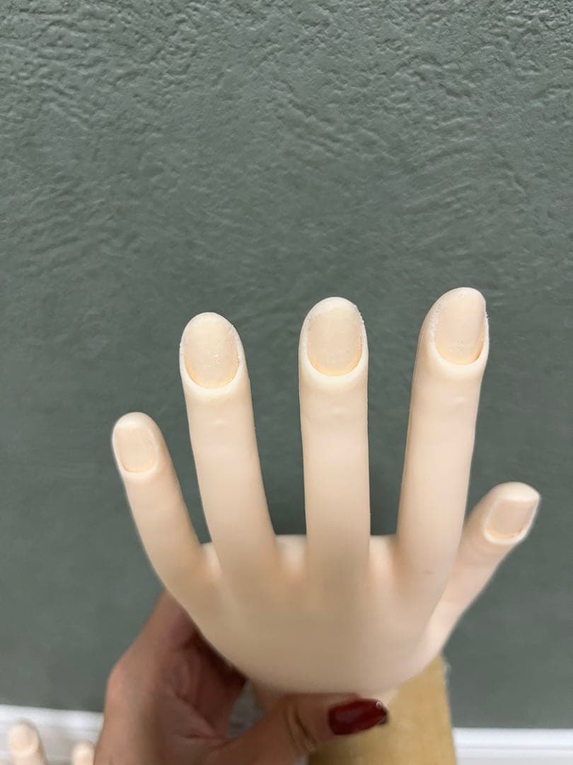 認定モデルハンド　骨折なし