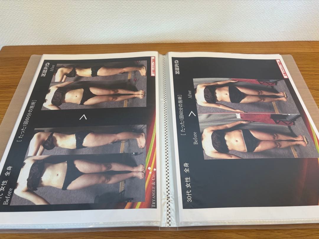 【送料込】キャビゼロ cavi ZERO 美容 キャビテーション エステ