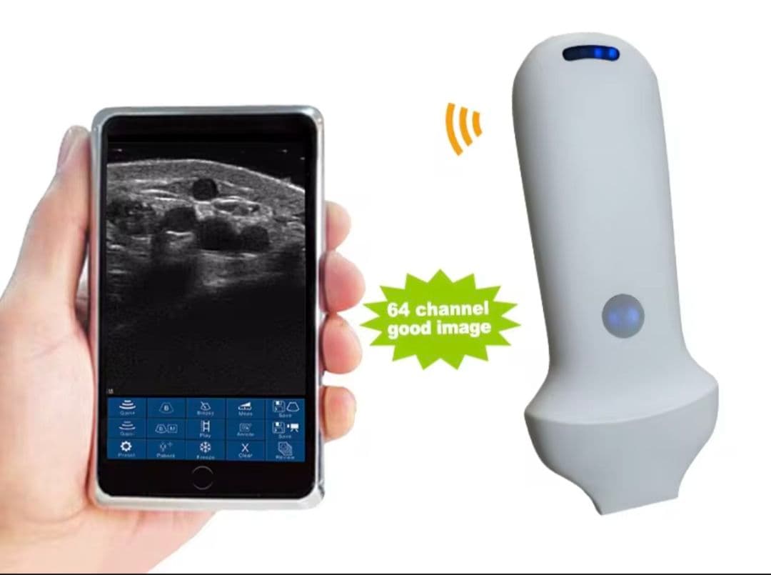 【極美品】ワイヤレスポータブルエコー　ドップラー搭載・3 in 1ハイブリッド