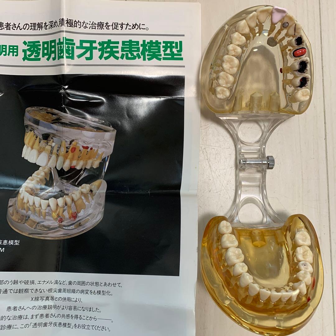 透明歯牙疾患模型