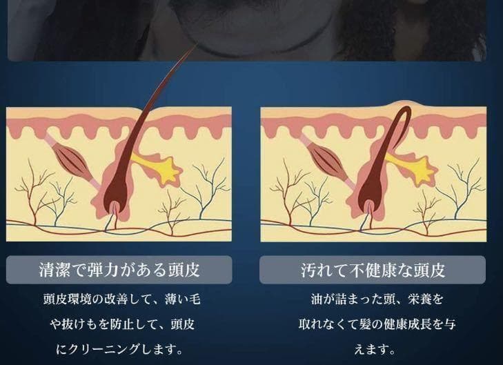 毎日家で極上ヘッドスパ❣プロ手技『母指回転揉捏法』搭載♪❤ヘッドマッサージャー