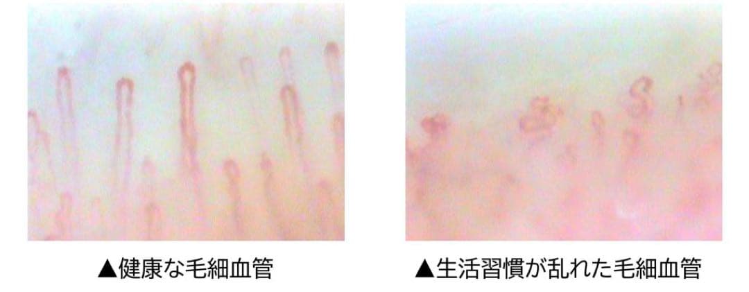 毛細血管スコープ　血管美人　SC-10