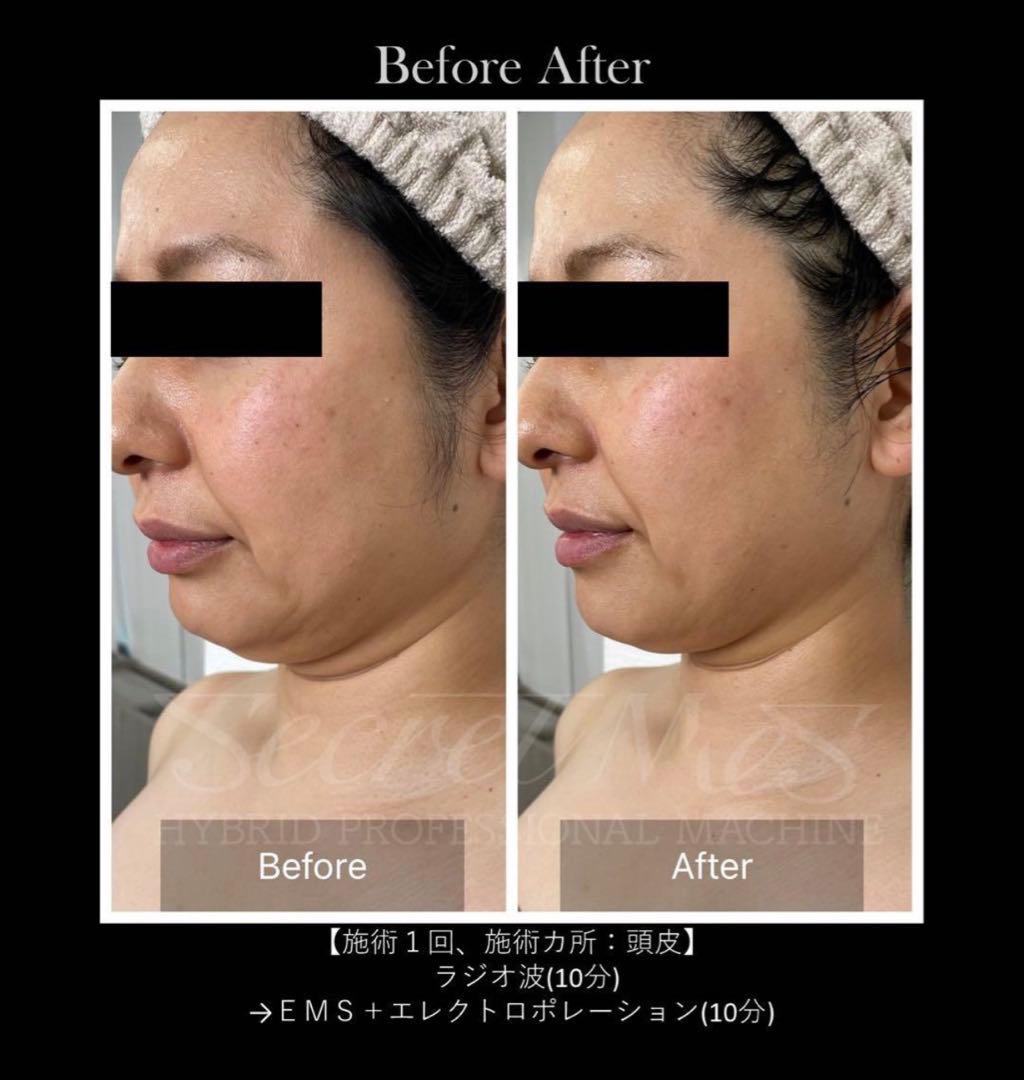 《美品》Secretmes 【シークレットメス】/残り１台/定価260万円