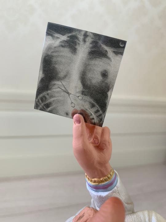 医者がレントゲンをにらむ・陶器製置物★ヨーロッパで購入！