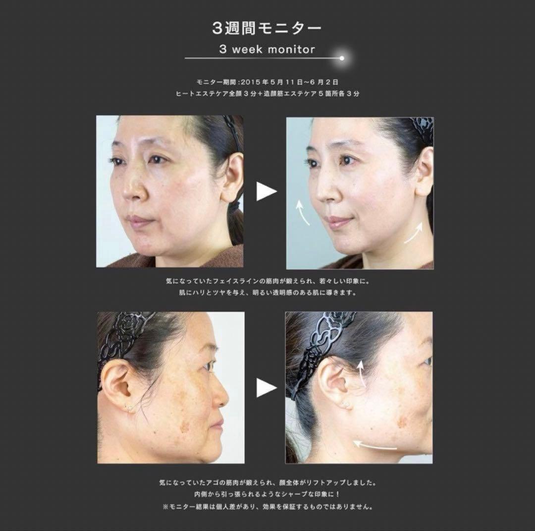 ZOGANKIN HYPER CL-SML008 美顔器 ゾーガンキン　ハイパー