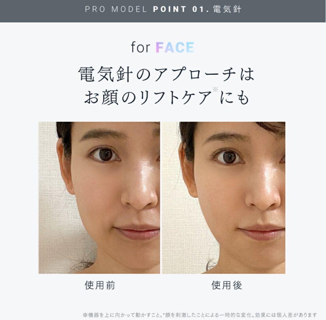 【最終セール！美品】MYTREX 電気針リフト 3種類のアタッチメント付