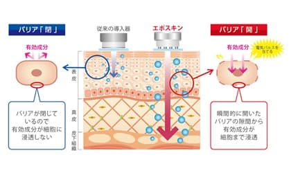 エポスキン　業務用美容機器　業務用エステ機器　エレクトロポレーション　毛穴洗浄