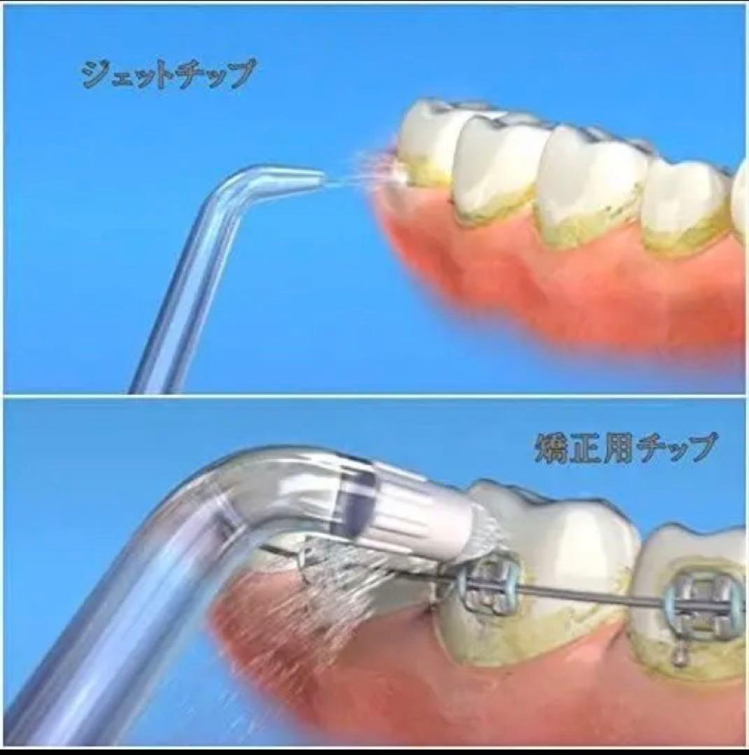 ウォーターフロッサー