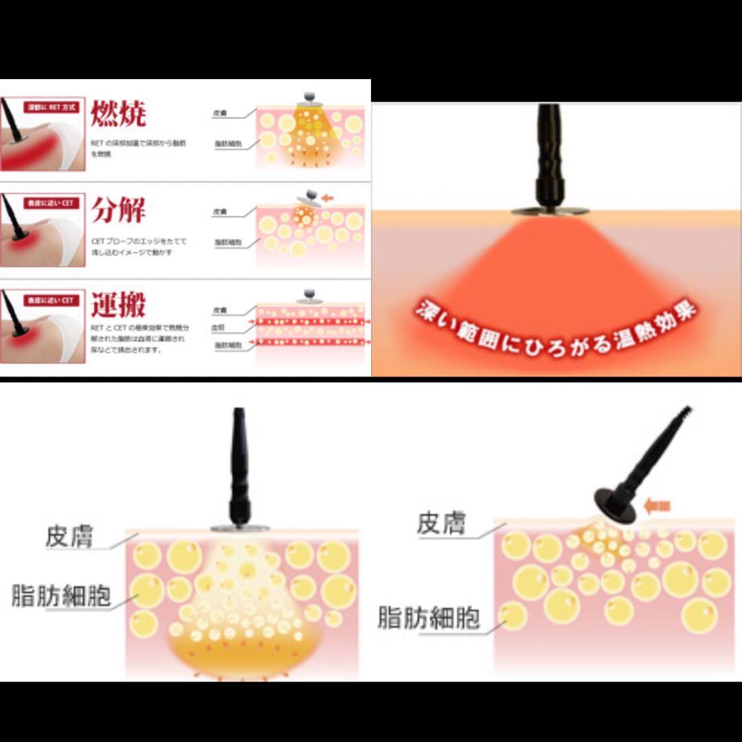 ラジオ派　高周波温熱機器RAFOS Premium ラフォス