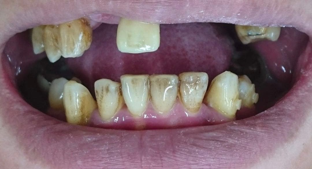 うんこの形の石　カノックスターのうんこ