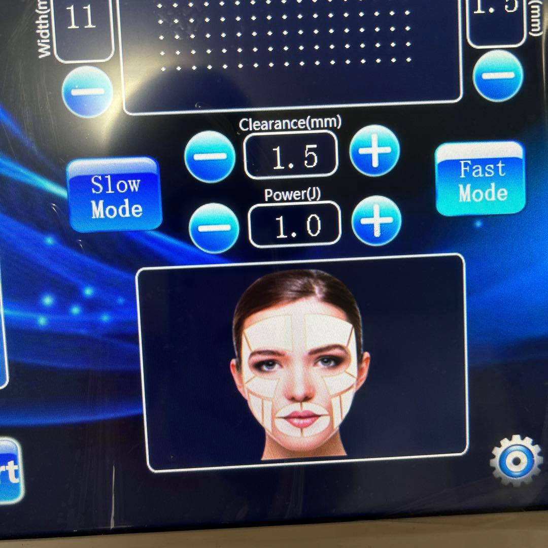 リフトアップ　エステ機器　フェムテック