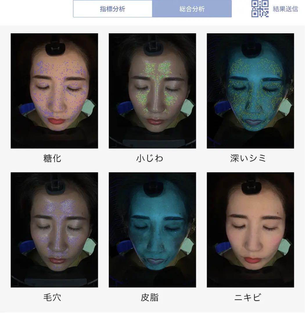 『AxFace』アクサフェイス 最新肌診断器 ビューティーワールド人気！