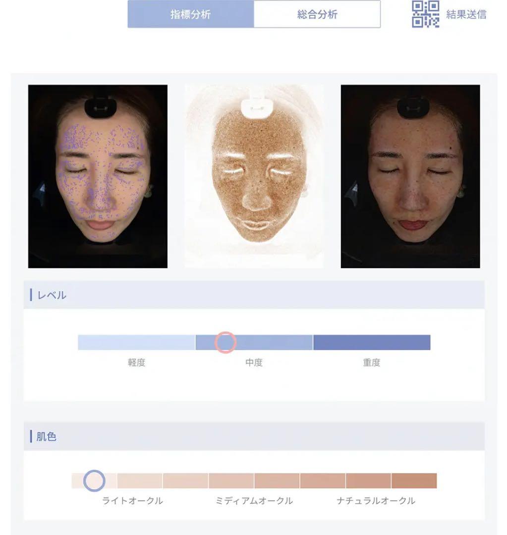 『AxFace』アクサフェイス 最新肌診断器 ビューティーワールド人気！