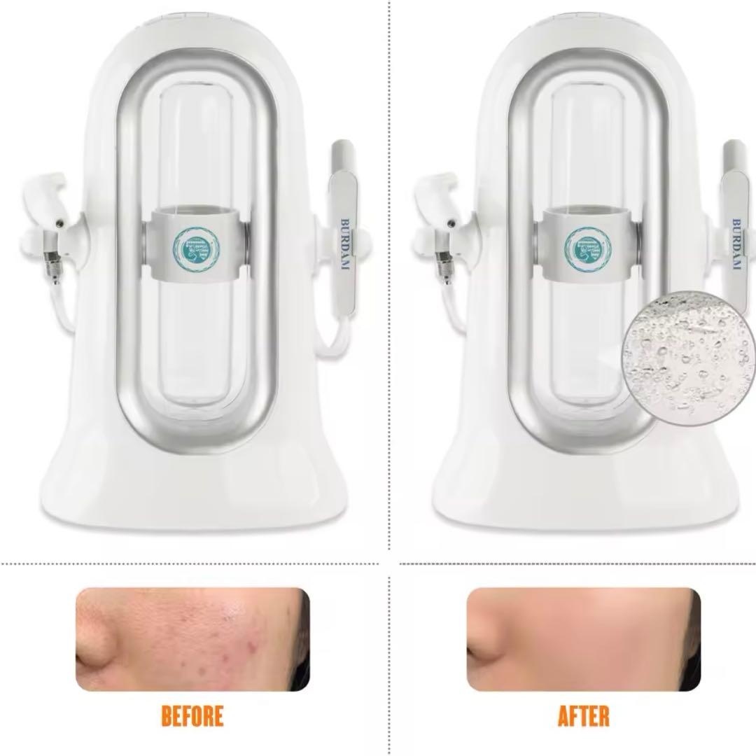 【新品】ハイドラフェイシャル おうちエステ　毛穴洗浄