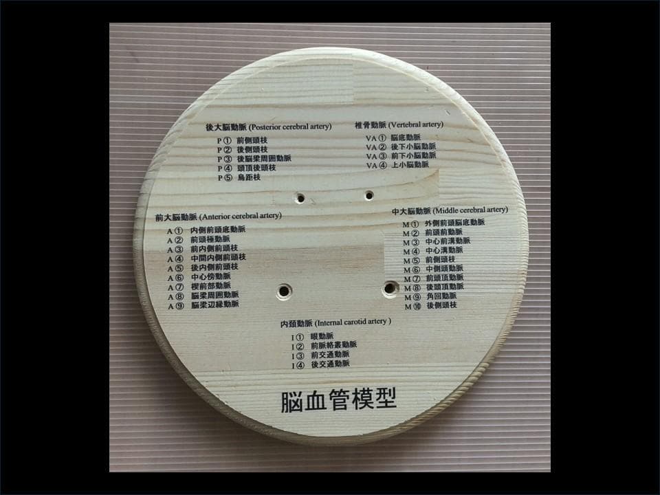 脳血管（内頚動脈、椎骨動脈）模型