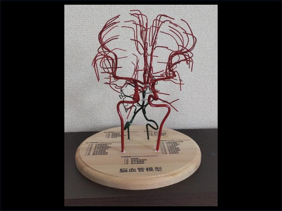 脳血管（内頚動脈、椎骨動脈）模型